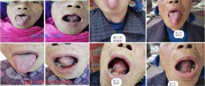 2024新春献礼专题报道 著名瑶医银疗推拿专家——周继辉