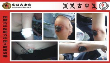 国医百科官方网站特别报道著名中医专家---文建昌