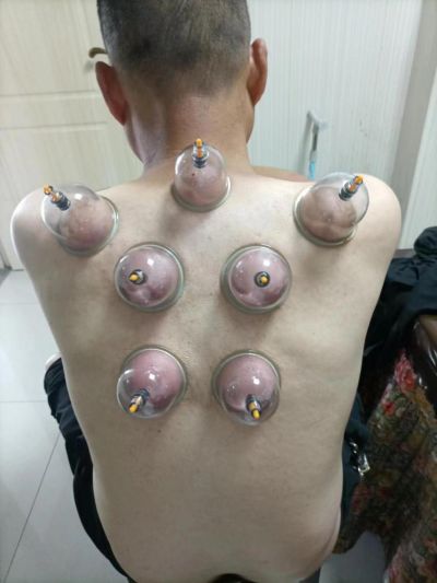 中国中医走向世界———方益初