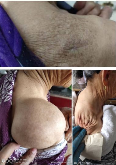 恭贺李新强李氏古针挑疗法第四代优秀传承人 荣获“国医泰斗”荣誉称号