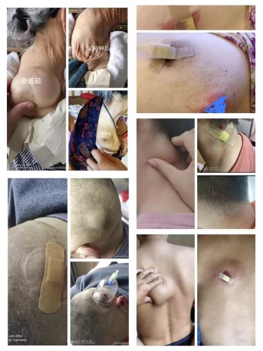 恭贺李新强李氏古针挑疗法第四代优秀传承人 荣获“国医泰斗”荣誉称号