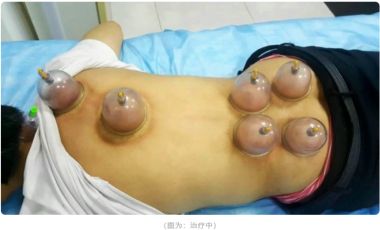 新时代国医名师 中医药优秀传承人——杨璧百