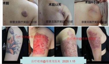 中国著名整形美容专家——蔡景龙