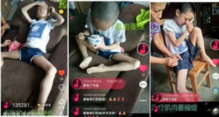 疑难病诊疗专家黎雪凤