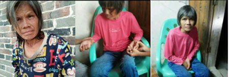 疑难病诊疗专家黎雪凤